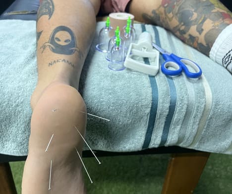 Fisioterapia